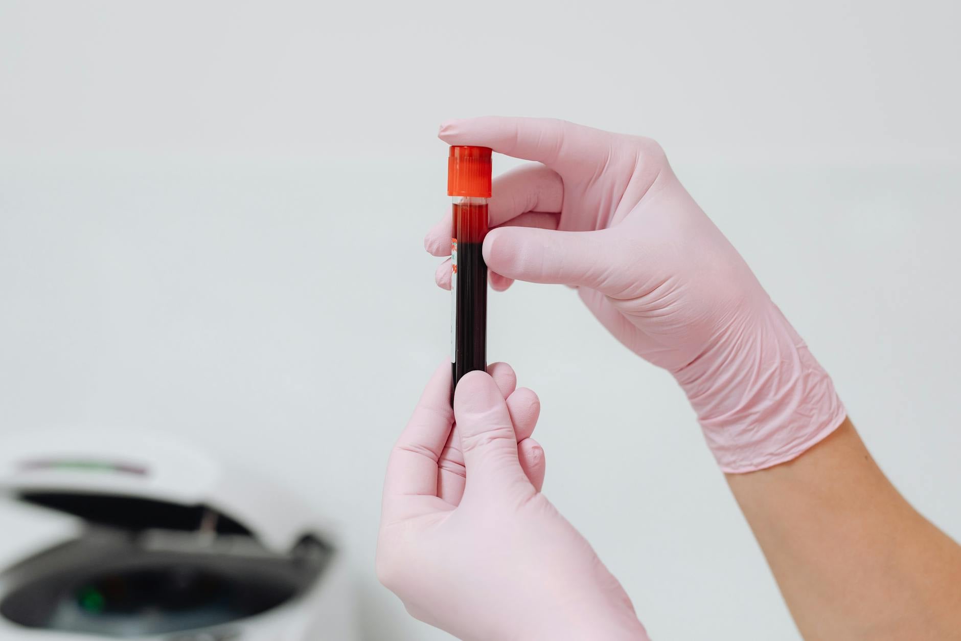 A gloved hand holding a blood sample tube